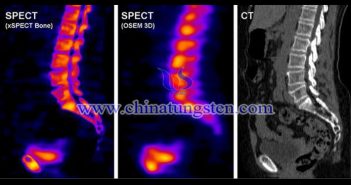 tungsten heavy alloy collimator applied for SPECT picture